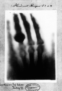 Who invented x rays?